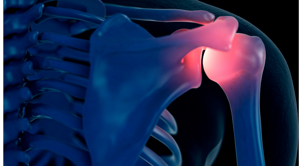 北浦和で肩こりの改善におすすめの整体-北浦和の肩こり専門整体院の肩こりと肩関節の痛み改善におすすめ記事-3