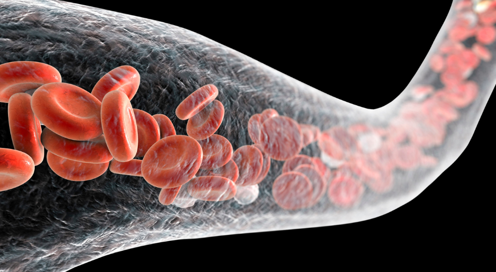 北浦和で肩こり改善におすすめの整体院-北浦和肩こり専門整体院の徒手筋膜リリーステクニック‐画像11