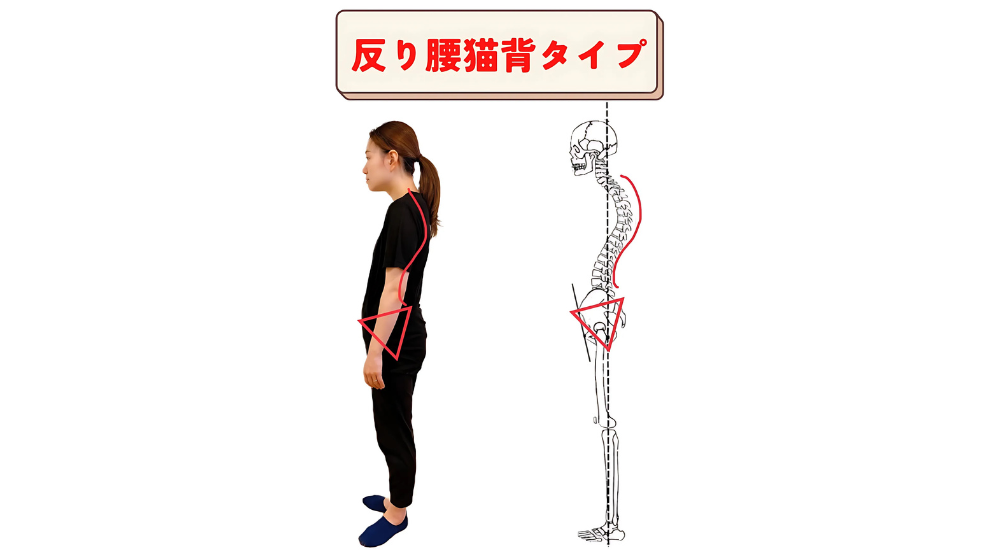 北浦和で肩こりの改善におすすめの整体-北浦和の肩こり専門整体院の肩こり改善におすすめ記事-2