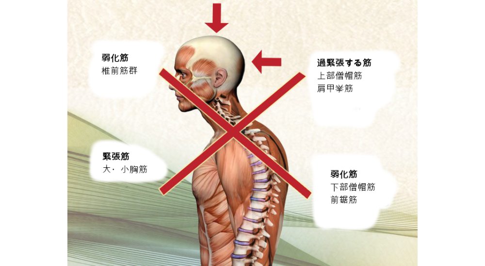 北浦和で肩こりの改善におすすめの整体-北浦和の肩こり専門整体院の肩こり改善におすすめ記事-10